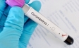 Российско-японский экспресс-тест на коронавирус может появиться в апреле